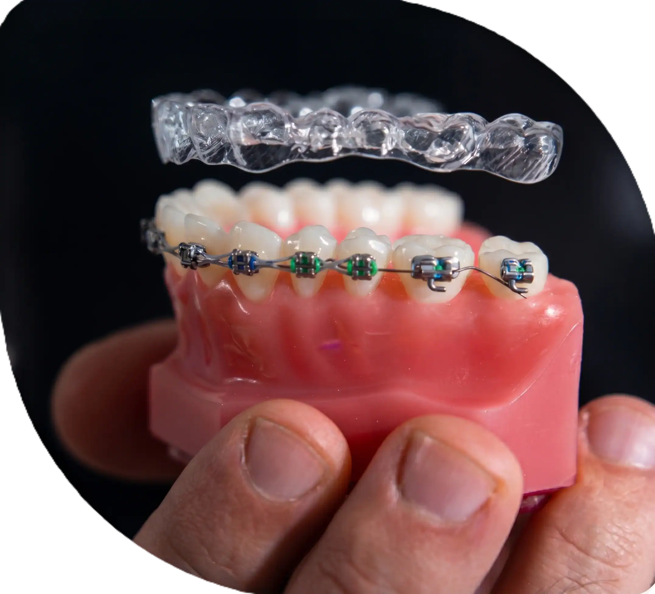 dental orthodontics
