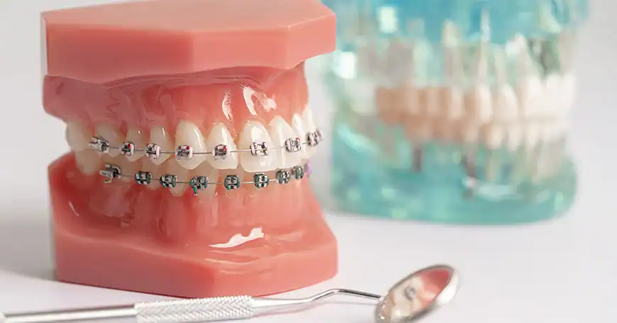 dental orthodontics before and after